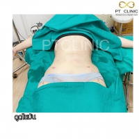 S__131678597.jpg - ดูดไขมัน แผลเล็กมาก เจ็บน้อย ชิวชิว ไม่ต้องวางยา | https://ptinfinity.com