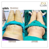 S__146980872.jpg - Review by วรกาญจน์ ทัศนากร | https://ptinfinity.com