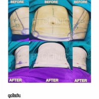 S__146972782.jpg - Review Nat Lertmukda | https://ptinfinity.com